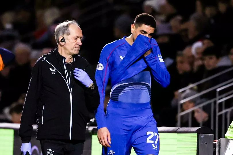 Nigerian defender Leon Balogun faces an uncertain spell on the sidelines after being forced off just 19 minutes into their match against St. Mirren at the SMISA Stadium.